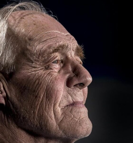 Alzheimer's