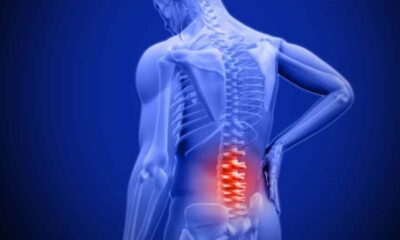 Spinal Injuries