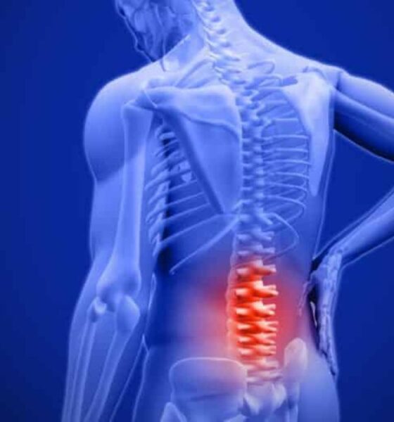 Spinal Injuries