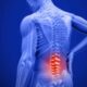 Spinal Injuries